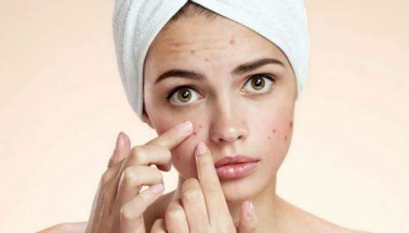 Do you know daily consumption of sweets and cakes can cause acne?