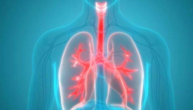 man coughed blood clot which exactly same of his lung passage