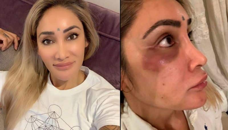 Sofia Hayat abused at a park in London