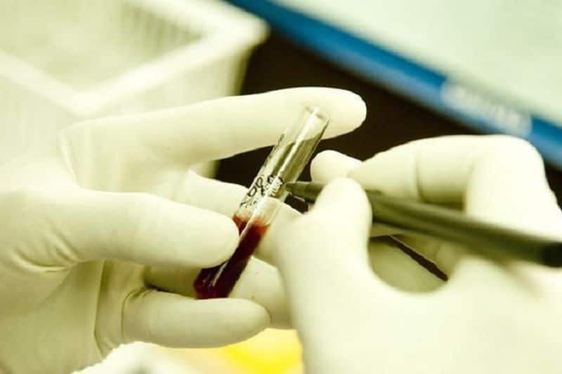 aids man death in madurai hospital