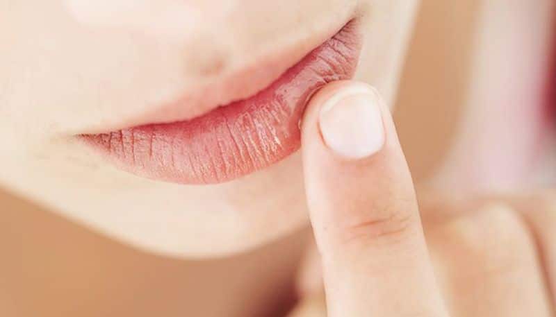 home remedies for dry lips in summer