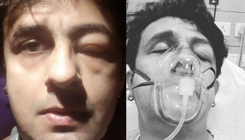 Sonu Nigam in ICU after food allergy; thanks fans for their love