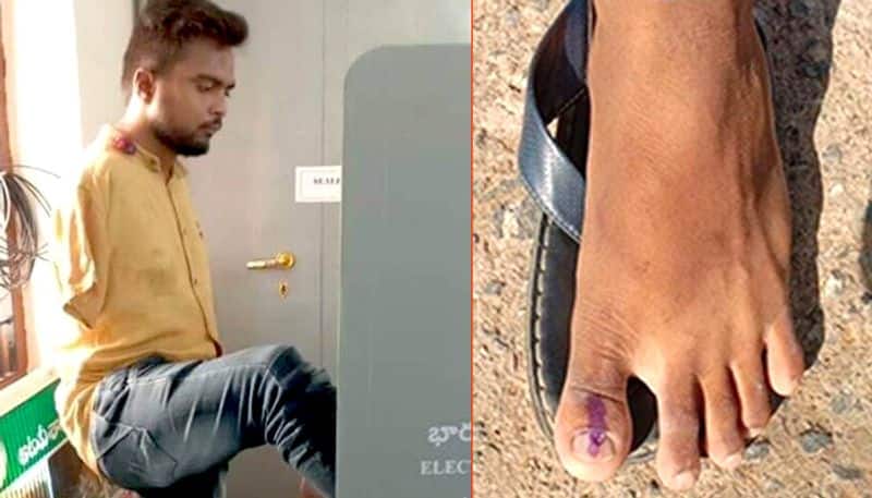Inspiring India vote Differently abled Hyderabad man votes  foot gets toe inked