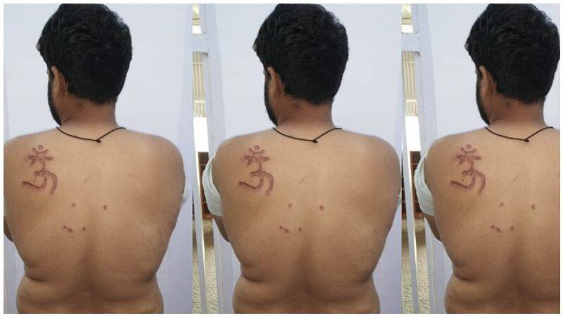 muslim Inmate in Tihar Branded With Om Symbol