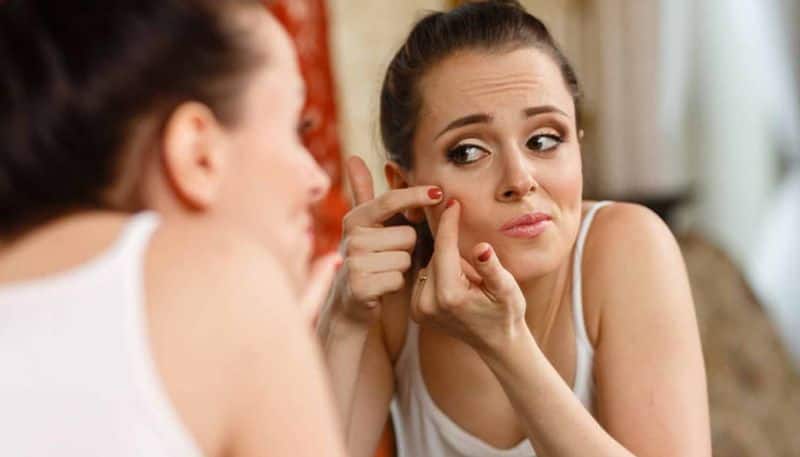 this is the best method to prevent pimples