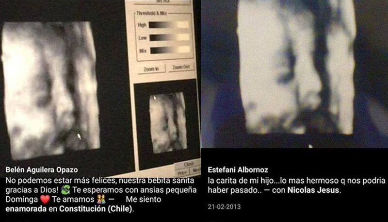 How the gynecologist who gave the same ultrasonogram printout to at least 40 women was finally caught