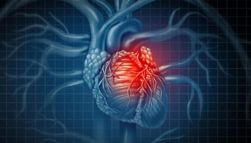 Tips for Recovering and Staying Well After a Heart Attack