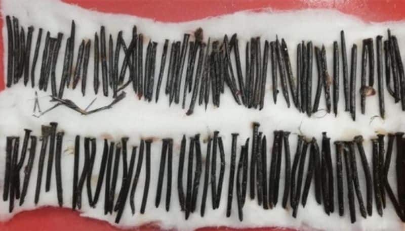 111 nails were removed from a patient s stomach