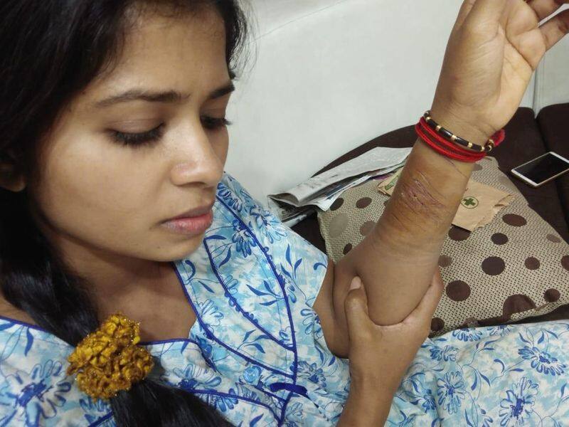 first time mathumitha hand injury photo released