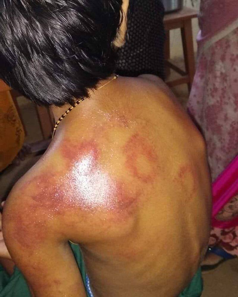 a small girl beaten by tution teacher