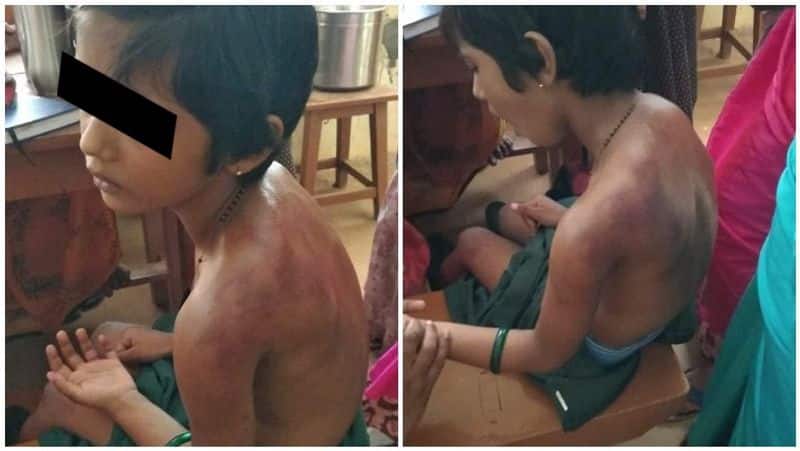 a small girl beaten by tution teacher