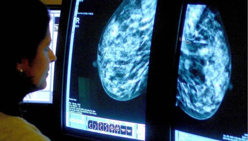 World Cancer Day 2022: Here are 7 steps that help to prevent breast cancer RCB