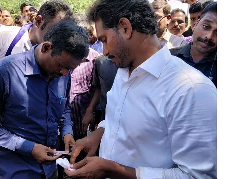 Ys jagan right hand fingers wounded