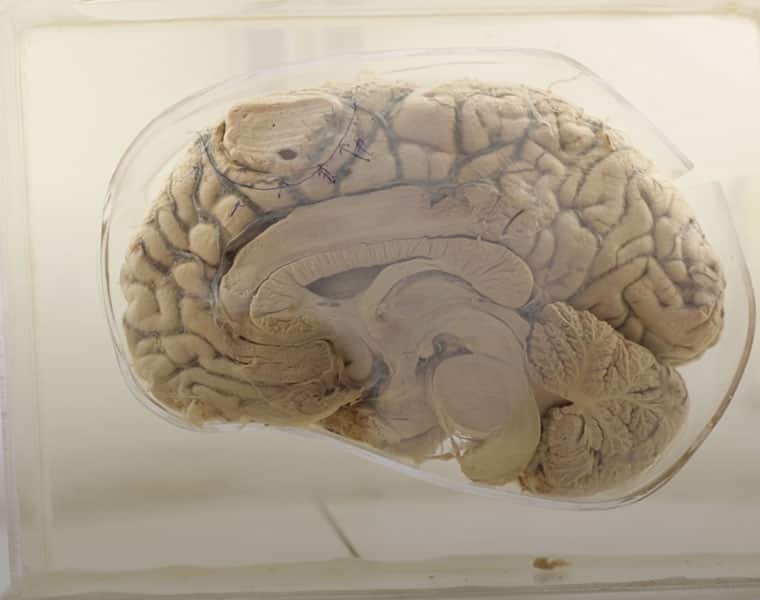10 Interesting Facts You should Know About  The Human Brain