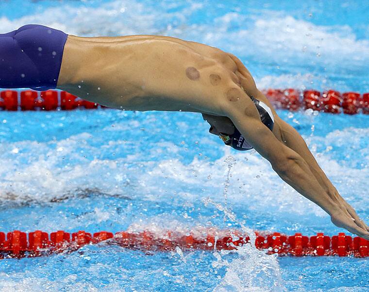 So, what are those marks on Michael Phelps' body?