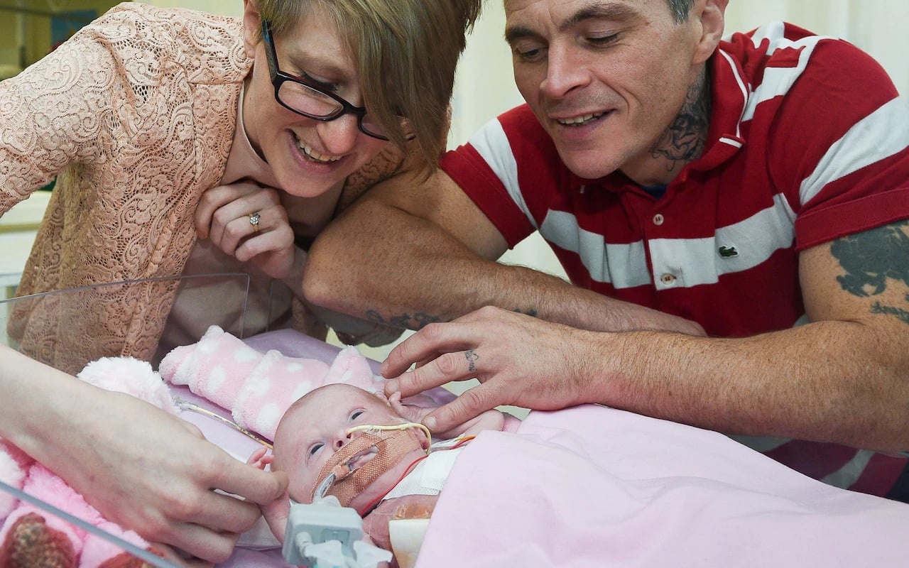 Miracle baby born with heart outside body