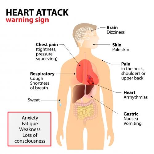 Tips to detect and avoid a heart stroke