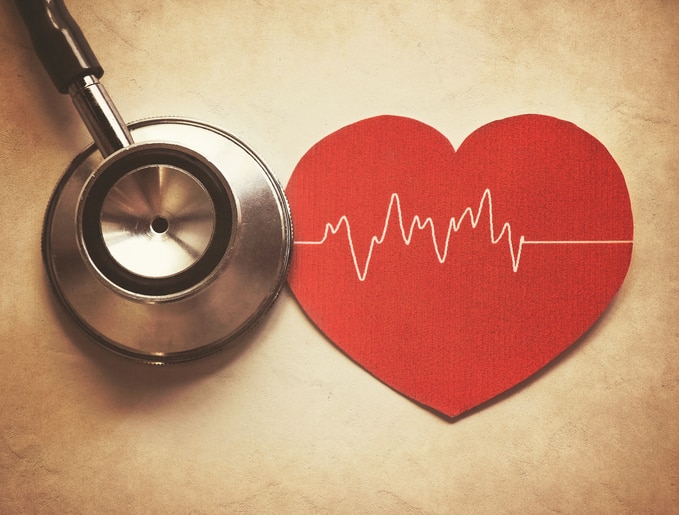 Arrthymia irregular heartbeat signs symptoms