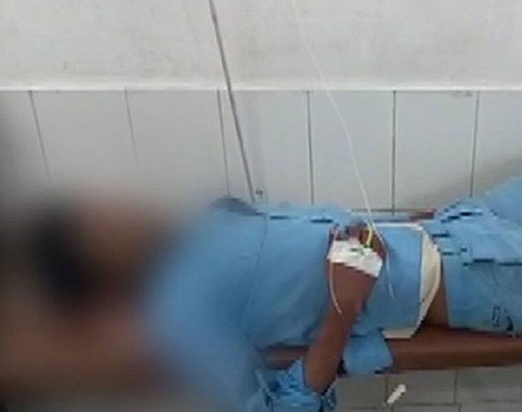 doctors use bus accident youth amputated leg as pillow in up