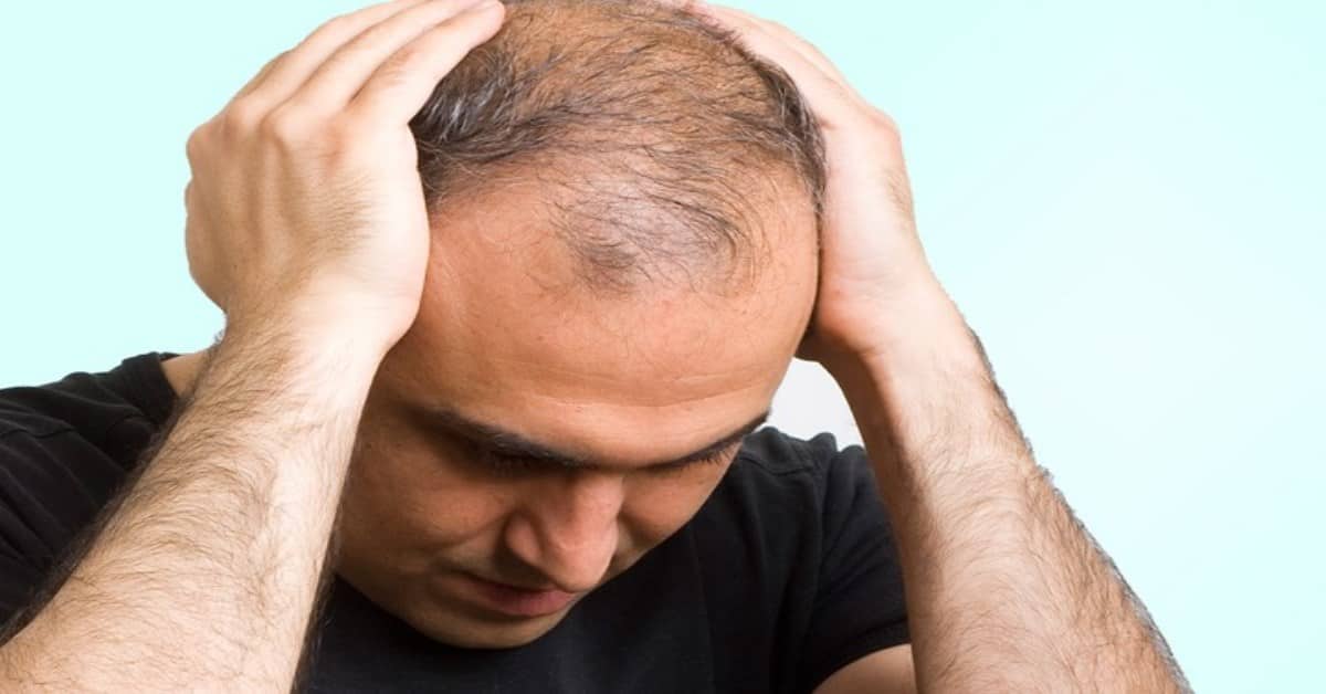 how to control hair loss