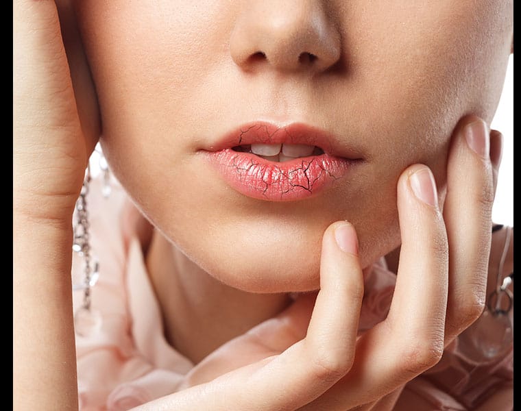 Natural Ways To Get Smooth Lips in Winters