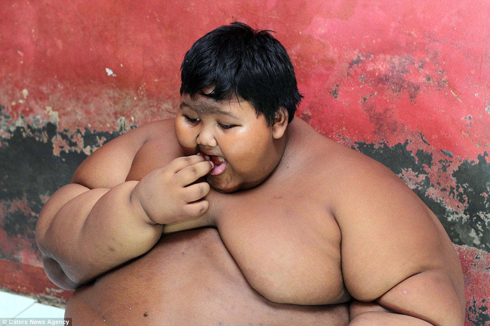 The worlds fattest boy