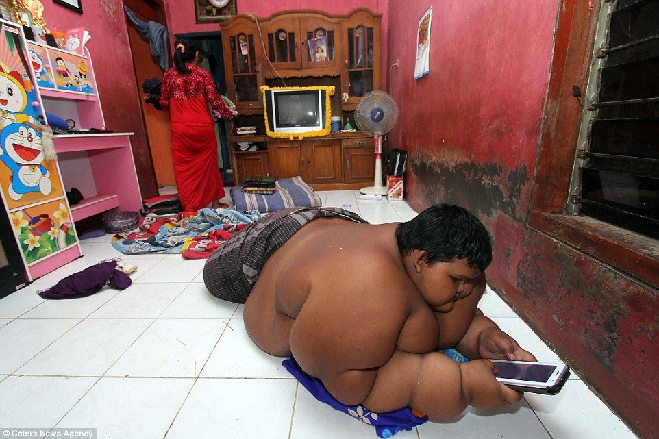 The worlds fattest boy
