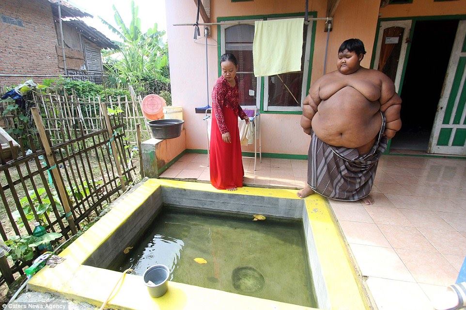 The worlds fattest boy