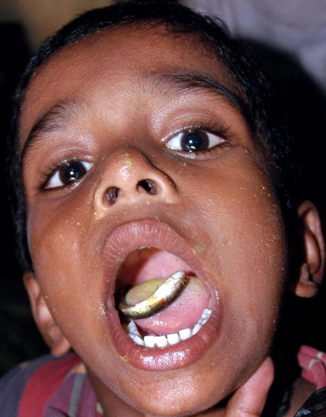 This medicinal fish can cure your asthma Pictures