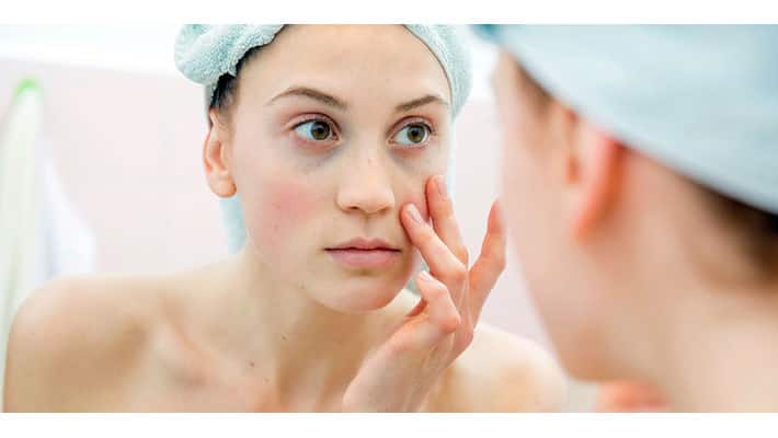 remedies to solve dark circles around eye remedies to solve dark circles around eye