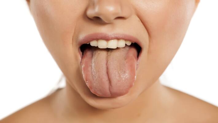 These color of the tongue will tell the health conditions BDD These color of the tongue will tell the health conditions BDD