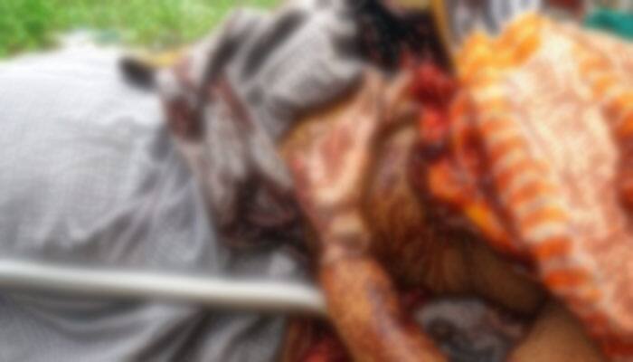 Murder Attempt On Beautician Padma At Hanuman Junction