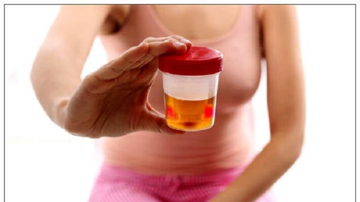 Cause of blood pigments in urine Cause of blood pigments in urine