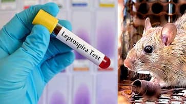Rat fever spreading rapidly in Kerala: What are the symptoms? How to prevent disease? Rat fever spreading rapidly in Kerala: What are the symptoms? How to prevent disease?