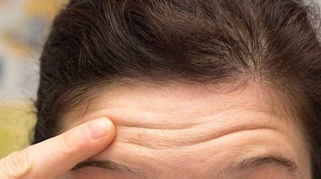 increase collagen production by these lifestyle tips and avoid wrinkles or fine lines increase collagen production by these lifestyle tips and avoid wrinkles or fine lines