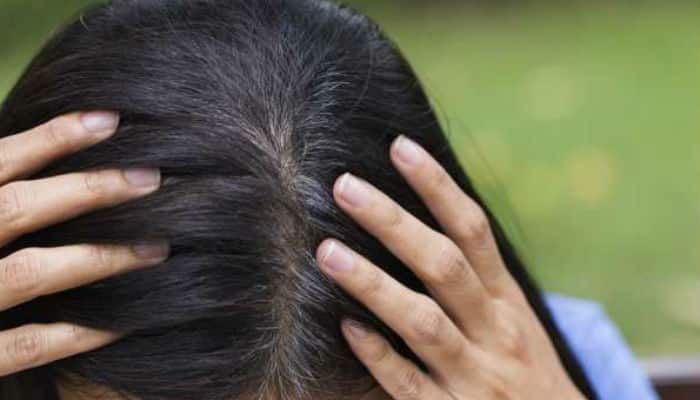 how to prevent grey hair and depression in  simple way