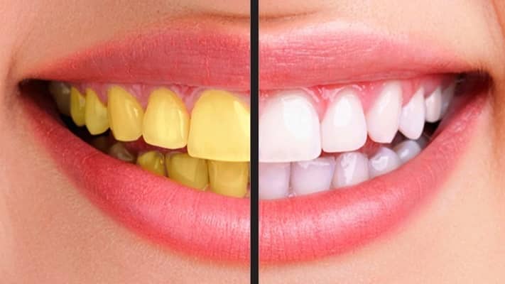 Natural Ways to Whiten Teeth Freshen Breath