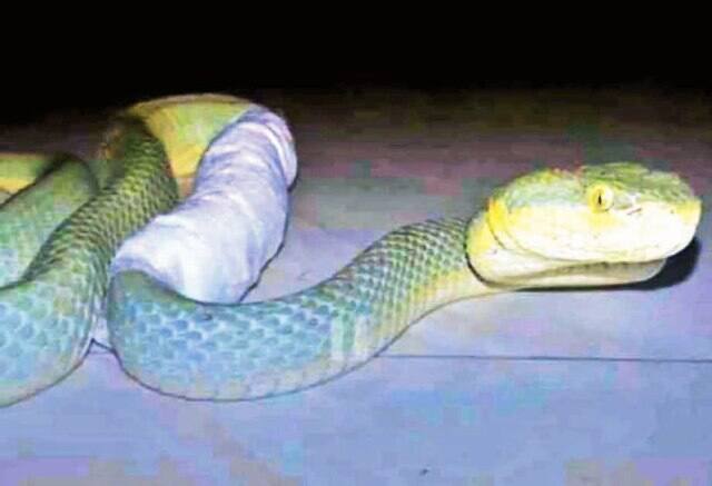 MRI SCAN taken for SNAKE  and gave treatment