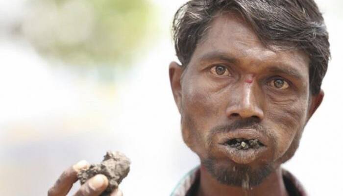 Man Who Eats 3 Kg Of Mud, Rocks And A Brick Every Day