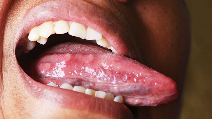 What your tongue says about your health What your tongue says about your health