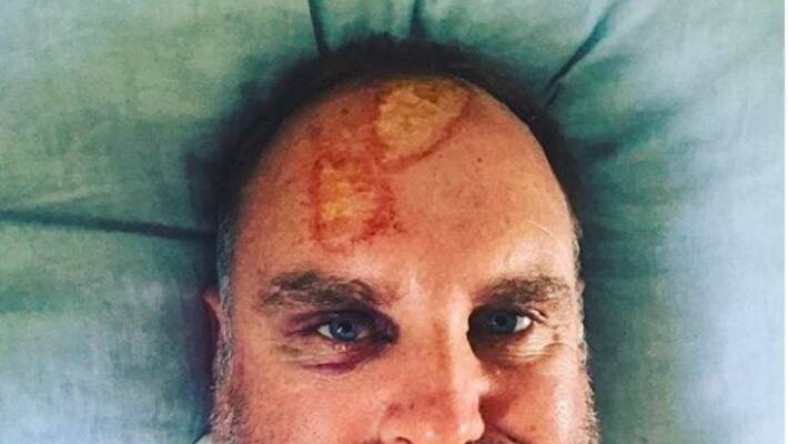 Cricket legend Mathew Hyden suffers head injury in accident Cricket legend Mathew Hyden suffers head injury in accident