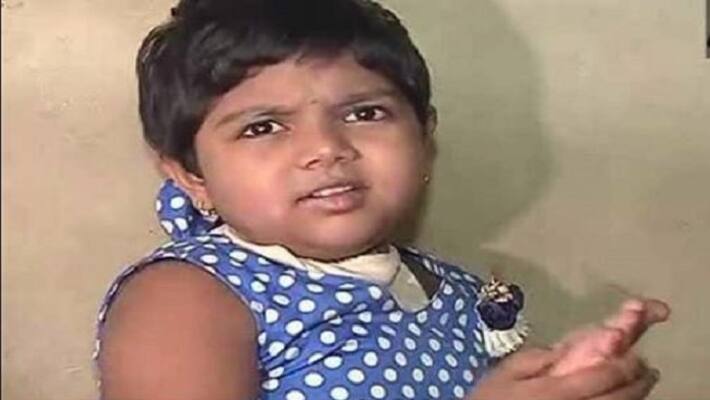 India's first skull implant surgery succeed in Pune India's first skull implant surgery succeed in Pune