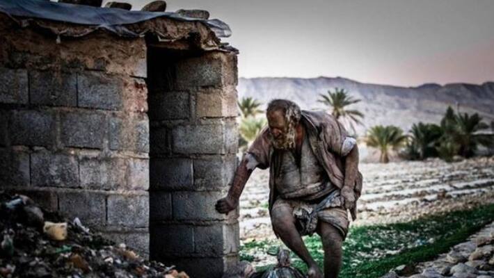 A man from Iran has no interest for bath in 60 years A man from Iran has no interest for bath in 60 years
