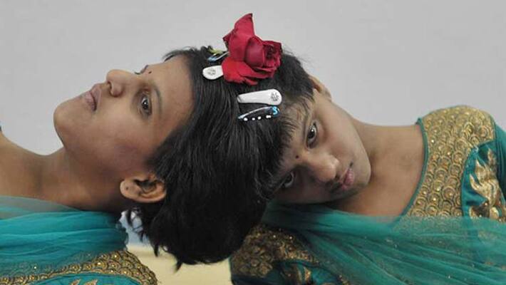 Conjoined twins from Hyderabad secure top ranks in SSC exams Conjoined twins from Hyderabad secure top ranks in SSC exams