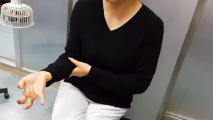 lady loses moving ability of fingers after using mobile phone for hours lady loses moving ability of fingers after using mobile phone for hours