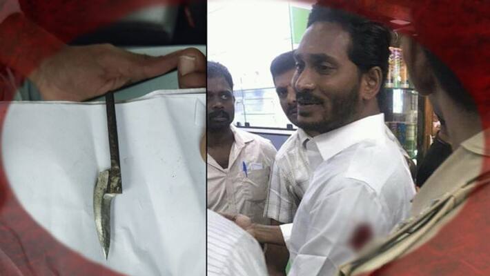 ys jagan attack case: court serious on media ys jagan attack case: court serious on media
