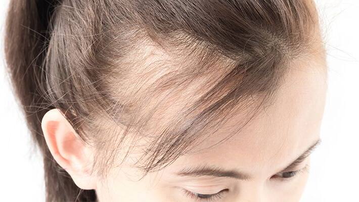 These Diseases Could Lead You To Lose Hair These Diseases Could Lead You To Lose Hair