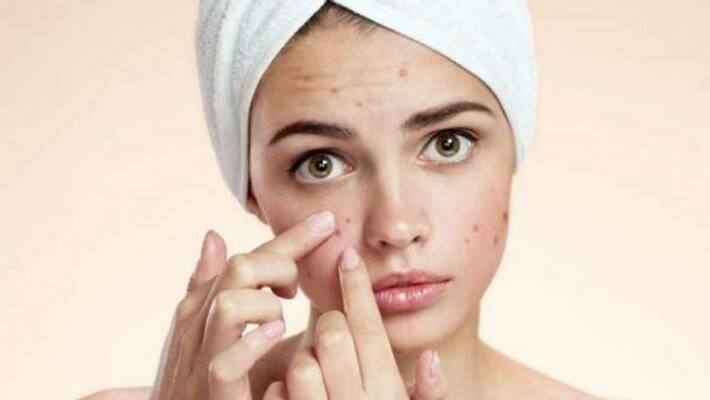 simple solutions to cure acne marks from face simple solutions to cure acne marks from face