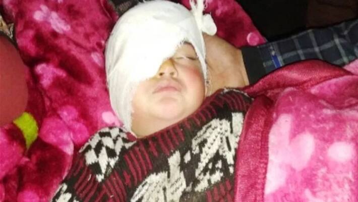 J&K govt gives financial aid to Kashmir youngest pellet victim J&K govt gives financial aid to Kashmir youngest pellet victim