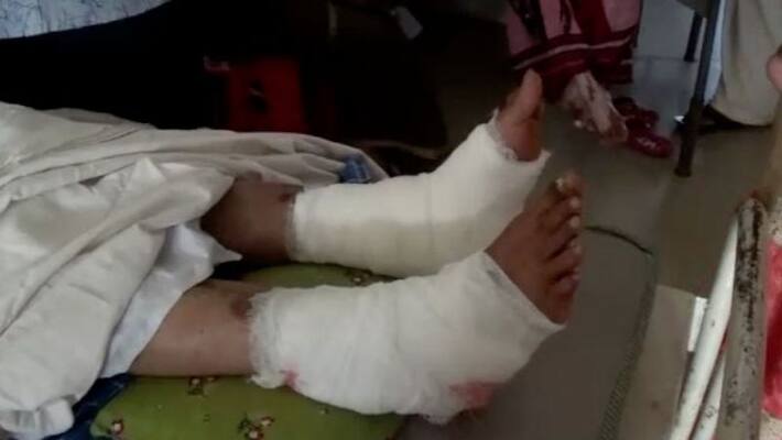 doctor operated patient right leg instead of left doctor operated patient right leg instead of left